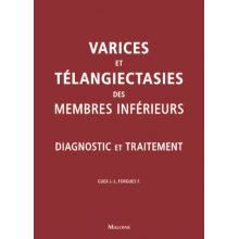 Varices et télangiectasies des membres inférieurs