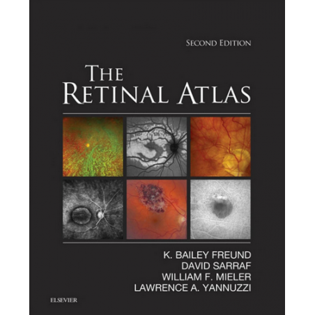 yannuzzi retina atlas free download