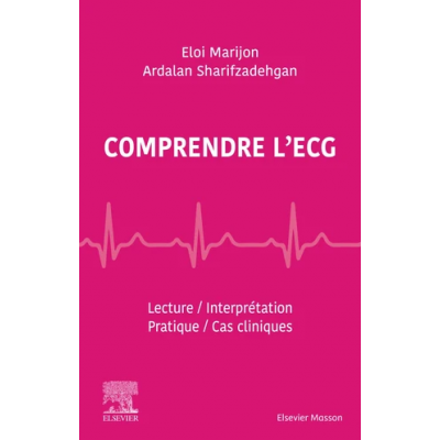 Comprendre l'ECG