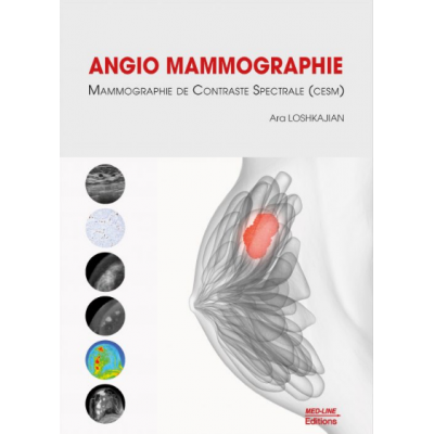 Angio-mammographie,...