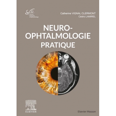 Neuro-ophtalmologie...