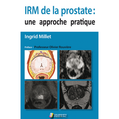 IRM de la prostate : une...