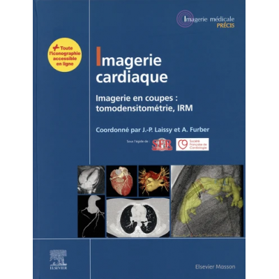 Imagerie cardiaque