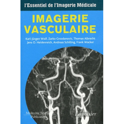 Imagerie vasculaire