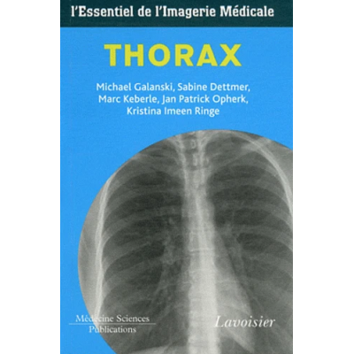 Thorax