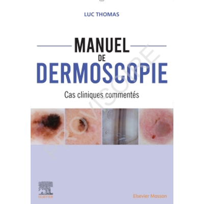 Manuel de dermoscopie