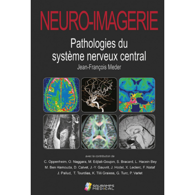 Neuro-imagerie :...