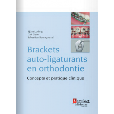 Brackets auto-ligaturants...