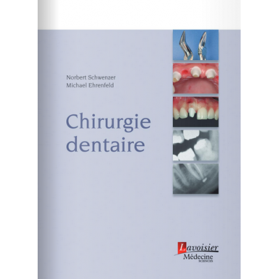 Chirurgie dentaire