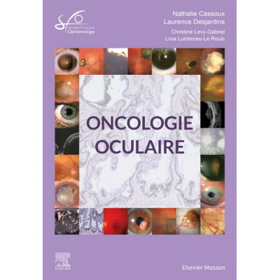 Oncologie oculaire -...