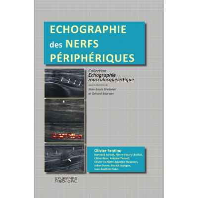 Echographie des nerfs...