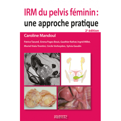 IRM du pelvis féminin : une...