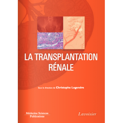 La transplantation rénale