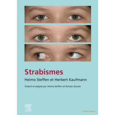 Strabismes