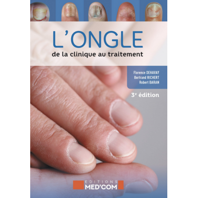 L'ongle