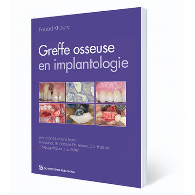 Greffe osseuse en...