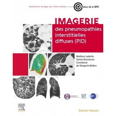 Imagerie des pneumopathies...