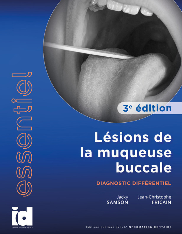 ESSENTIEL – Lésions de la muqueuse buccale Diagnostic différentiel 3e édition