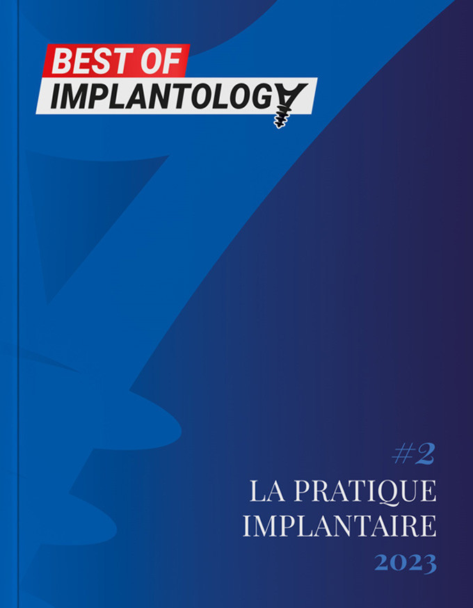 BEST OF IMPLANTOLOGY La pratique implantaire 2023