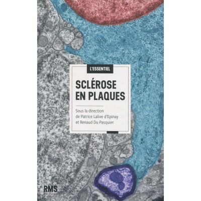 Sclérose en plaques