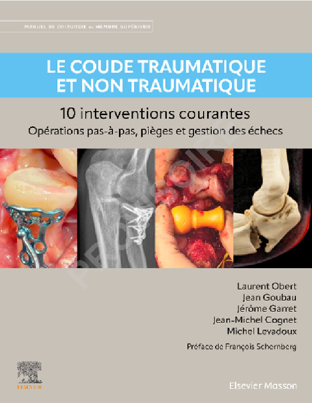 Le coude traumatique et non traumatique - 10 interventions courantes: Manuel de chirurgie du membre supérieur