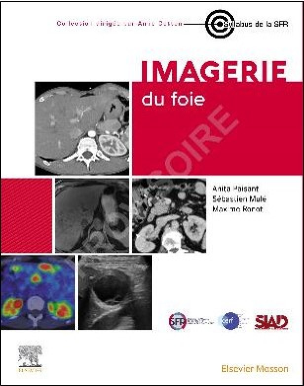 Imagerie du foie