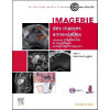 Imagerie des masses annexielles: Lexique O-RADS et corrélations radiopathologiques