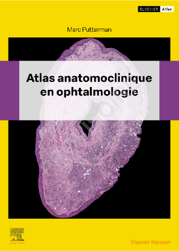 Atlas anatomoclinique en Ophtalmologie