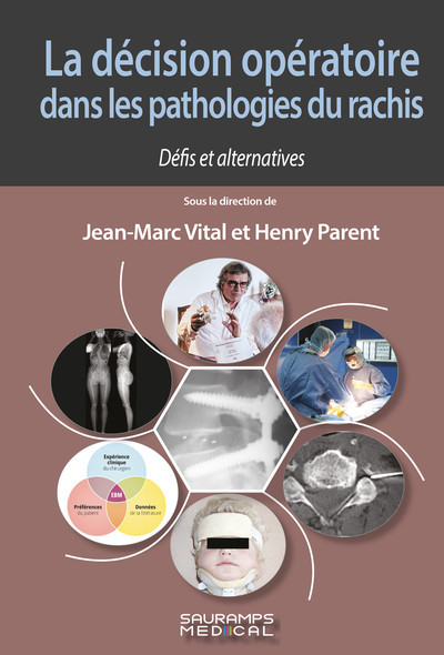 La décision opératoire dans les pathologies du rachis - Défis et alternatives