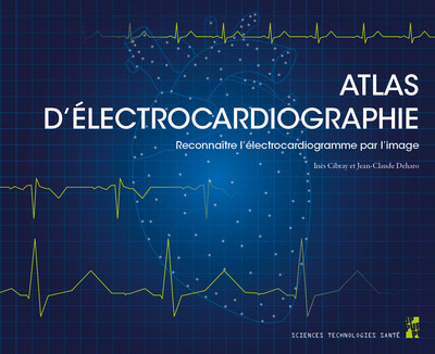 Atlas d’électrocardiographie - Reconnaître l’électrocardiogramme par l’image