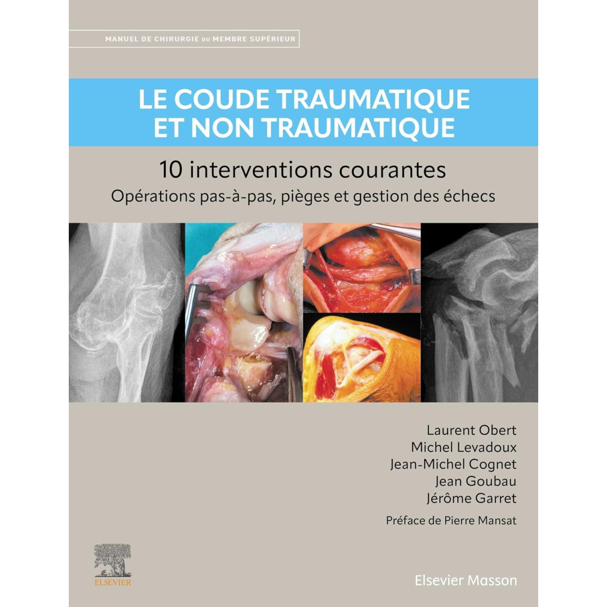 Le coude traumatique et non traumatique - 10 interventions courantes : manuel de Chirurgie du membre supérieur