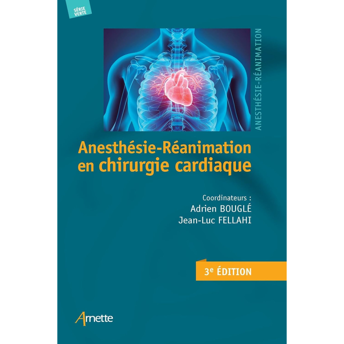 Anesthésie-réanimation en chirurgie cardiaque