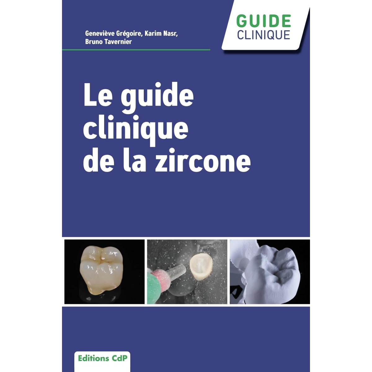 Le guide clinique de la zircone