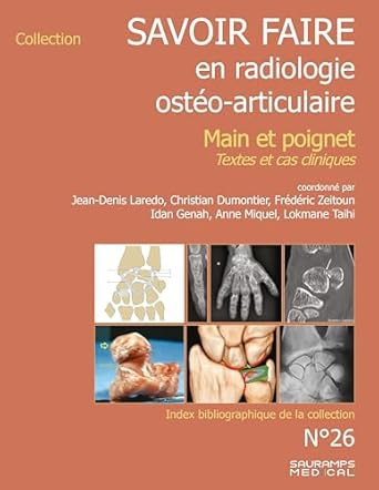 Savoir-farie en Radiologie ostéo-articulaire n°26 - Main et poignet