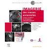 Imagerie des masses annexielles - Lexique O-RADS et corrélations radiopathologiques