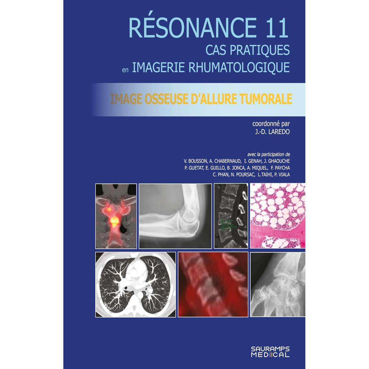 Imagerie osseuse d'allure tumorale - Cas pratiques en imagerie musculosquelettique