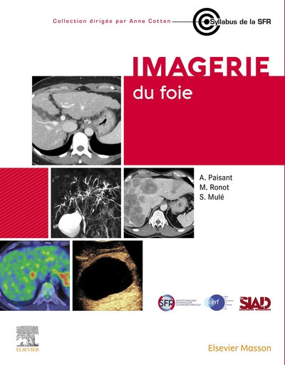 Imagerie du foie