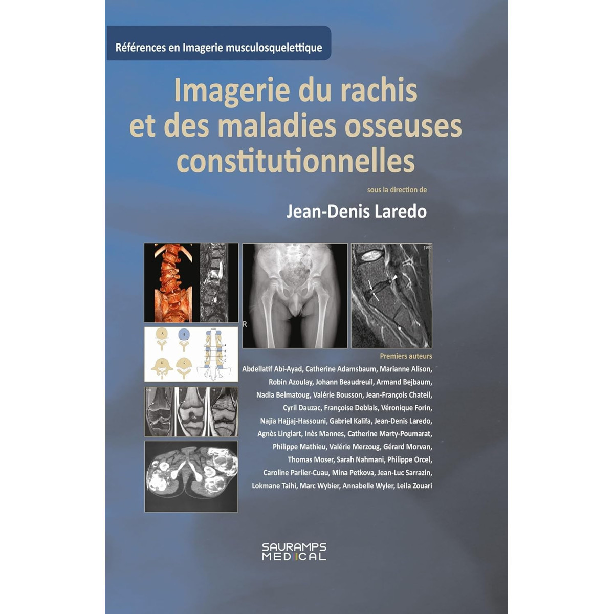 Imagerie du rachis et des maladies osseuses constitutionnelles