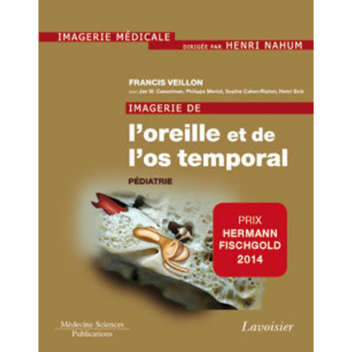 Imagerie de l'oreille et de l'os temporal - Tome 5, Pédiatrie