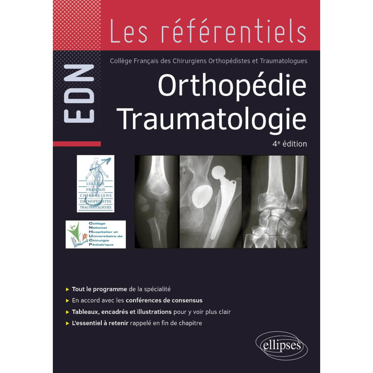 Orthopédie Traumatologie