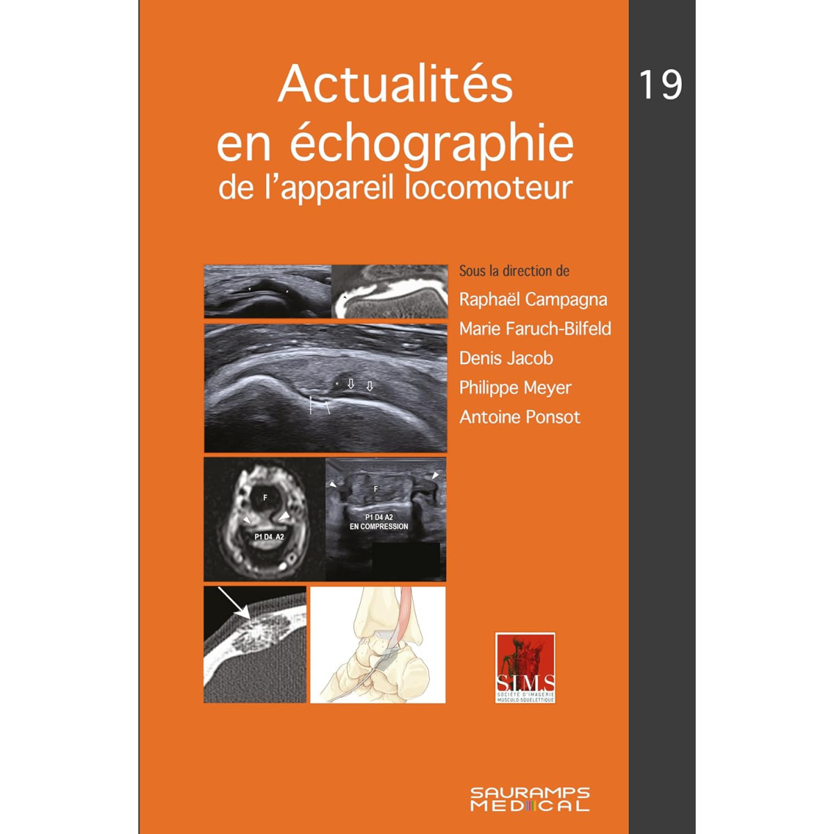 Actualités en échographie de l'appareil locomoteur - N° 19