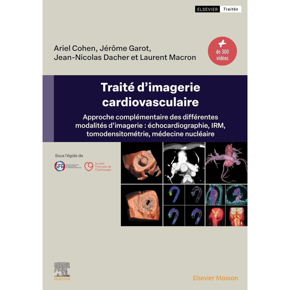 Traité d'imagerie cardiovasculaire