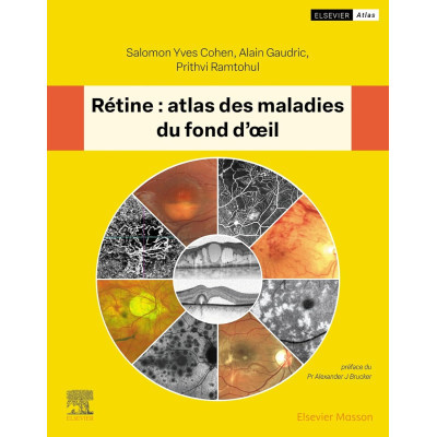 Rétine : atlas des maladies...