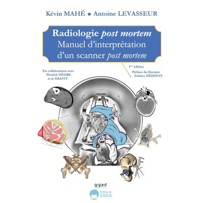 Radiologie post-mortem -...