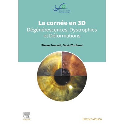 La cornée en 3D -...