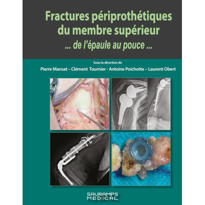 Fractures périprothétiques...