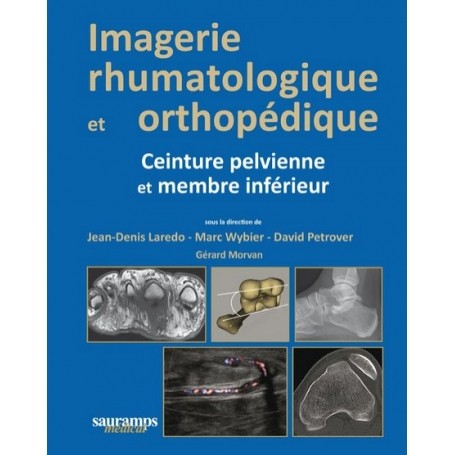 Imagerie rhumatologique et orthopédique, tome 3