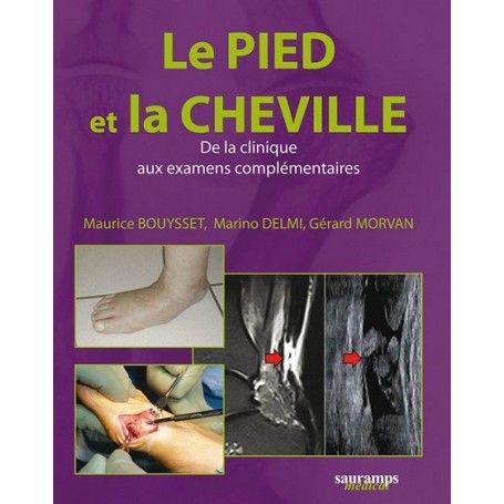 Le pied et la cheville