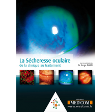 La sécheresse oculaire