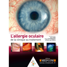 L'allergie oculaire